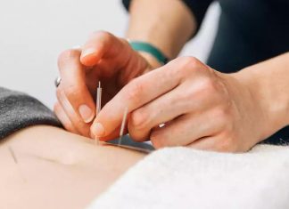 Acupuntura, especialidade reconhecida pelo CFM, equilibra corpo e energia