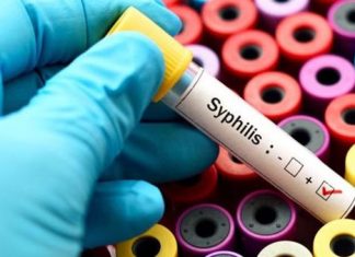 Saúde alerta para a prevenção e controle da sífilis