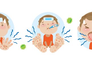 Virose infantil do Verão: síndrome mão-pé-boca