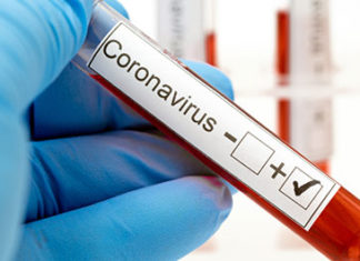 Levantamento do IBGE mostra que 520 mil fizeram teste para Covid-19 no Paraná