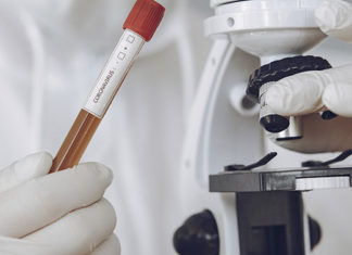 Pesquisa identifica percentual da população adulta com anticorpos contra Covid-19 UENP-DIVULGA