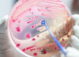 Sepse: importância do diagnóstico precoce e preocupação com a COVID-19 SEPSE