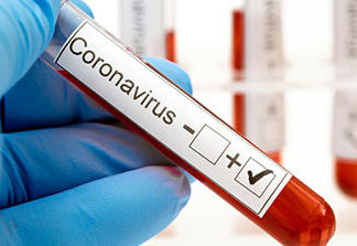 Quase 1 milhão de paranaenses já fizeram teste para detectar Coronavírus