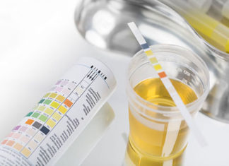 Saber a cor da urina é uma das formas de manter a saúde dos rins