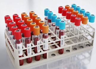 Produtores rurais de Bandeirantes poderão fazer exames gratuitos para avaliar nível de exposição aos agrotóxicos