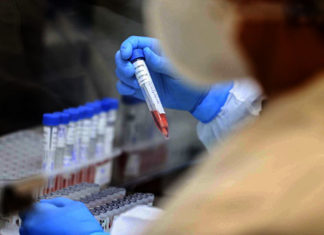 Paraná registra 262 casos de Influenza H3N2; transmissão da doença é considerada comunitária