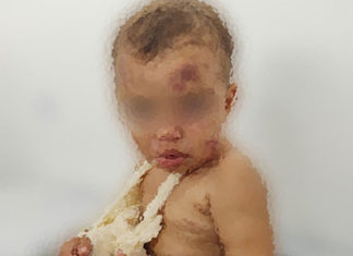 Criança de dois anos é torturada pela mãe