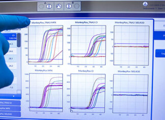 Paraná registra mais 16 casos de Monkeypox e chega a 243 diagnósticos positivos
