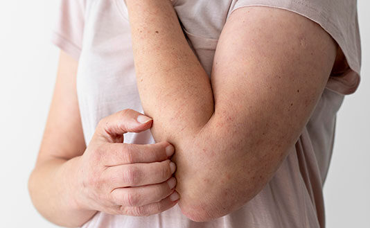 Por que, quando não tratada adequadamente, a hanseníase pode voltar?