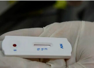 Saúde orienta farmácias sobre testes para HIV, sífilis e hepatites teste de HIV