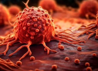 69% dos brasileiros consideram câncer evitável, mas 65% não sabem bem como se prevenir, revela pesquisa