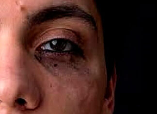 Mulher trans é brutalmente agredida após Fetexas em Jacarezinho