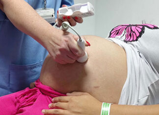 Ultrassom morfológico passa a ser ofertado a 100% das gestantes atendidas no Paraná
